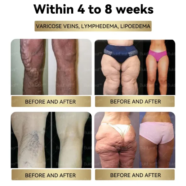 𝑪𝒓𝒂𝒛𝒚𝑳𝒆𝒂𝒇® Tirzepatide 𝗚𝗜𝗣/𝗚𝗟𝗣-𝟭 𝗗𝘂𝗮𝗹-𝗔𝗰𝘁𝗶𝗼𝗻 𝑺𝒍𝒊𝒎𝒎𝒊𝒏𝒈 & 𝑯𝒆𝒂𝒍𝒕𝒉 𝑩𝒐𝒐𝒔𝒕 𝑫𝒓𝒐𝒑𝒔