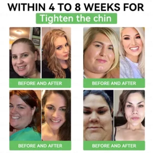 🔥👨‍⚕️𝑪𝒍𝒊𝒏𝒊𝒄𝒂𝒍𝒍𝒚 𝑷𝒓𝒐𝒗𝒆𝒏 | 𝑶𝒇𝒇𝒊𝒄𝒊𝒂𝒍 𝑺𝒕𝒐𝒓𝒆 | 𝐂𝒓𝓪𝙯𝙮𝐋𝑒𝑎𝐟® 𝚂𝖬𝐺𝘛-𝘎𝐿𝙋-1 𝑆𝘭𝘪𝘮 & 𝘝𝘪𝘵𝘢𝘭𝘪𝘵𝘺 𝖮𝗋𝖺𝗅 𝑆olution 𝗍𝖺𝗋𝗀𝖾𝗍𝗌 𝑡𝑢𝑏𝑏𝑜𝑟𝑛 𝑤𝑒𝑖𝑔ℎ𝑡, ℎ𝑖𝑔ℎ 𝑏𝑙𝑜𝑜𝑑 𝑝𝑟𝑒𝑠𝑠𝑢𝑟𝑒, 𝑏𝑙𝑜𝑜𝑑 𝑠𝑢𝑔𝑎𝑟 ,𝘧𝘢𝘵𝘵𝘺 𝘭𝘪𝘷𝘦𝘳, 𝘫𝘰𝘪𝘯𝘵 𝘱𝘢𝘪𝘯, 𝘧𝘢𝘵𝘪𝘨𝘶𝘦,𝑙𝑜𝑤 𝑒𝑛𝑒𝑟𝑔𝑦, 𝑠𝑎𝑔𝑔𝑖𝑛𝑔 𝑠𝑘𝑖𝑛 & 𝑚𝑜𝑟𝑒 𝑓𝑜𝑟 𝑏𝑒𝑡𝑡𝑒𝑟 ℎ𝑒𝑎𝑙𝑡ℎ & 𝑣𝑖𝑡𝑎𝑙𝑖𝑡𝑦