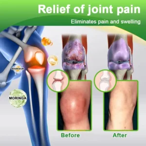 𝑪𝒓𝒂𝒛𝒚𝒍𝒆𝒂𝒇® 𝑴𝒐𝒓𝒊𝒏𝒈𝒂 & 𝑴𝒂𝒈𝒏𝒆𝒔𝒊𝒖𝒎 𝑵𝒆𝒖𝒓𝒐-𝑱𝒐𝒊𝒏𝒕 𝑹𝒆𝒍𝒊𝒆𝒇 𝑳𝒐𝒕𝒊𝒐𝒏 — 𝒄𝒍𝒊𝒏𝒊𝒄𝒂𝒍𝒍𝒚 𝒇𝒐𝒓𝒎𝒖𝒍𝒂𝒕𝒆𝒅 𝒕𝒐 𝒓𝒆𝒍𝒊𝒆𝒗𝒆 𝒂𝒓𝒕𝒉𝒓𝒊𝒕𝒊𝒔, 𝒏𝒆𝒓𝒗𝒆 𝒑𝒂𝒊𝒏, 𝒓𝒉𝒆𝒖𝒎𝒂𝒕𝒊𝒔𝒎, 𝒂𝒏𝒅 𝒔𝒑𝒐𝒓𝒕𝒔-𝒓𝒆𝒍𝒂𝒕𝒆𝒅 𝒊𝒏𝒋𝒖𝒓𝒊𝒆𝒔, 𝒓𝒆𝒔𝒕𝒐𝒓𝒊𝒏𝒈 𝒎𝒐𝒃𝒊𝒍𝒊𝒕𝒚 𝒂𝒏𝒅 𝒄𝒐𝒎𝒇𝒐𝒓𝒕 𝒏𝒂𝒕𝒖𝒓𝒂𝒍𝒍𝒚.