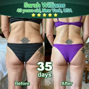 𝑅𝑜𝑝𝑐𝑒𝑒𝑟® 𝑆𝑡𝑒𝑚 𝐶𝑒𝑙𝑙 & 𝐶𝑜𝑙𝑙𝑎𝑔𝑒𝑛 𝑃𝑒𝑝𝑡𝑖𝑑𝑒 𝑂𝑟𝑎𝑙 𝐷𝑟𝑜𝑝𝑠