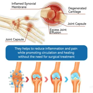 | 𝐋𝐚𝐬𝐭 𝐃𝐚𝐲 𝐏𝐫𝐨𝐦𝐨𝐭𝐢𝐨𝐧 𝟖𝟎% 𝐎𝐅𝐅 |  🇨🇦 Croaie® ʙ.ᴘ.ᴄ-157 Joint Healing Cream🦴Treats Arthritis, Neuropathy, Rheumatism, Sports Injuries & More🌸🌸