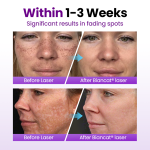 Biancat® SpotErase Probiotic Shield Serum