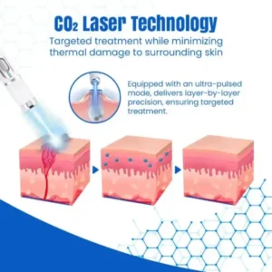 Bikenda® DermZap Mole & Wart Removal Laser Pen