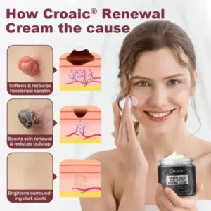 Croaie® KeraErase RICEDUAL-ACTION RENEWAL CREAM