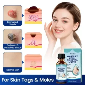 Timilk® WartLift Corn Removal Liquid