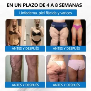 ๐๐ข๐ฌ๐๐ซ๐ข๐ฌ๐ยฎ ๐๐-๐๐ง-๐ ๐๐๐ซ๐๐๐ซ๐ข๐ง๐ ยท ๐๐๐+/๐๐๐ ร ๐๐๐ญ๐ซ๐ข๐ฑ๐ฒ๐ฅ ๐๐๐๐ ๐๐๐ฏ๐๐ง๐๐๐ ๐๐ข๐ฉ๐จ๐ฌ๐จ๐ฆ๐๐ฅ ๐๐tch