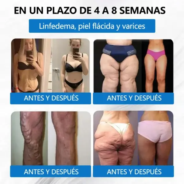 ๐๐ข๐ฌ๐๐ซ๐ข๐ฌ๐ยฎ ๐๐-๐๐ง-๐ ๐๐๐ซ๐๐๐ซ๐ข๐ง๐ ยท ๐๐๐+/๐๐๐ ร ๐๐๐ญ๐ซ๐ข๐ฑ๐ฒ๐ฅ ๐๐๐๐ ๐๐๐ฏ๐๐ง๐๐๐ ๐๐ข๐ฉ๐จ๐ฌ๐จ๐ฆ๐๐ฅ ๐๐tch